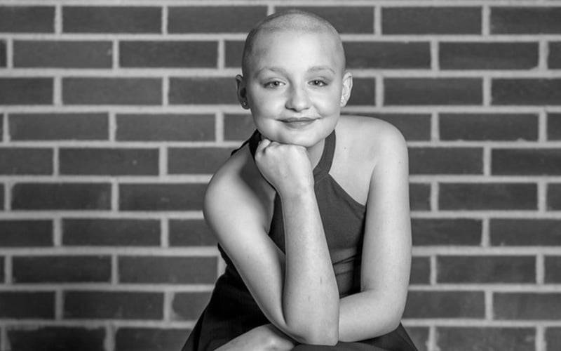 a child with no hair seated with her chin on her hand
